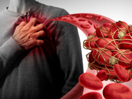 uudised_meditsiin_tromboos_vaktsiin